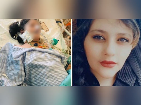 इरानमा पक्राउ परेकी २२ वर्षीया महिला महसा अमिनीको प्रहरी हिरासतमा मृत्यु